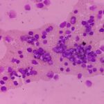 discovery-key-to-reduc