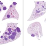 new-combination-of-dru