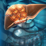 Human liver cancer cell growth. 3d illustration