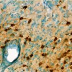 brain-penetrating-drug