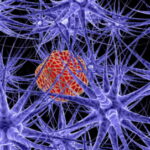 disease in brain cell