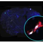 study-of-cerebral-bloo
