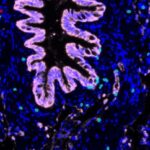 study-reveals-how-pati