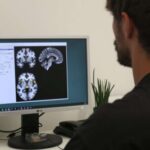 fibromyalgia-changes-t