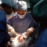 gastric-cancer