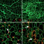 when-stem-cells-cant-r