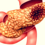 Untitled-design-17 (1)