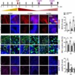 multiple-sclerosis-new-2