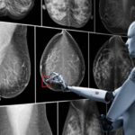 AI_Mammographie-696x464