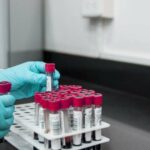 blood-test-2