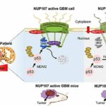 brain-cancer-linked-to