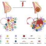 breast-cancer-recurren