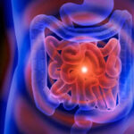 ibd-inflammatory-bowel-disease