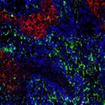 study-sheds-light-on-w-1