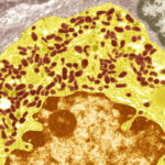 _20231016_on_long_covid_seratonin