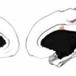 brain-connectivity-is