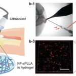 gel-repairs-cartilage-1 (1)