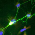 neuron (5)