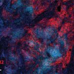 study-identifies-genet-1