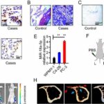 study-reveals-promisin