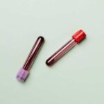 blood-test-5