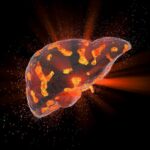 Liver-Disease-Concept-Illustration-777x518