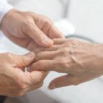 arthritic-hands-what-w