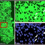 bone-marrow-adipocytes