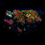 new-therapeutic-approa