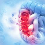 Colon cancer. Colon disease concept. 3d illustration