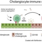 primary-sclerosing-cho