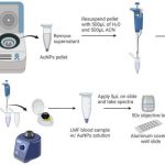 a-blood-test-will-diag (1)