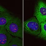 accumulation-of-junk-p