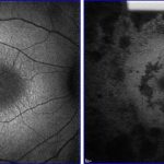 revitalizing-vision-me