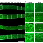 seeing-a-path-to-nerve