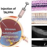treatment-for-blindnes