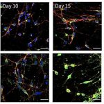 why-is-the-brain-so-pr