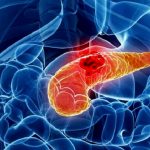 pancreas-2