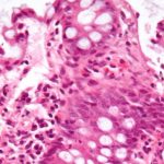 6-inflammatory (1)