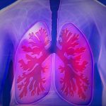 copd (1)