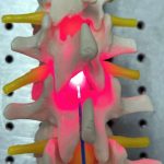 red-light-therapy-for