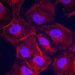 collagen-II-dancing-stained970__FitMaxWzk3MCw2NTBd