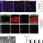 nih-researchers-discov-1