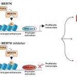 fibrosis-lacks-treatme