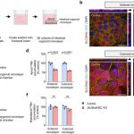 gut-reaction-low-level