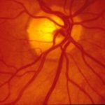 human-retina-2022-11-14-02-10-16-utc-300x199