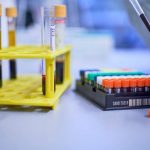 impressive-results-aga