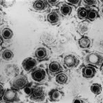 Herpes_simplex_virus_TEM_B82-0474_lores (1)