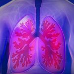 lung-1