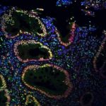 how-nerve-stimulation